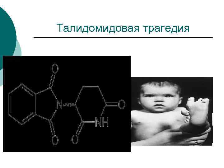 Талидомидовая трагедия 