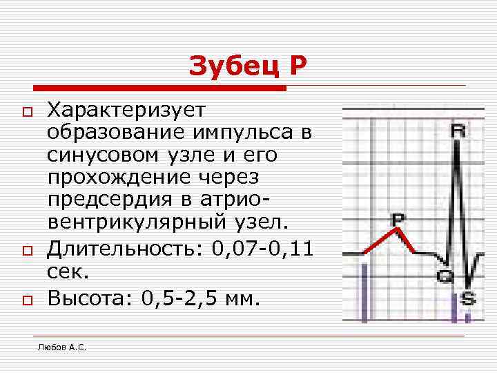    Зубец Р o  Характеризует образование импульса в синусовом узле и