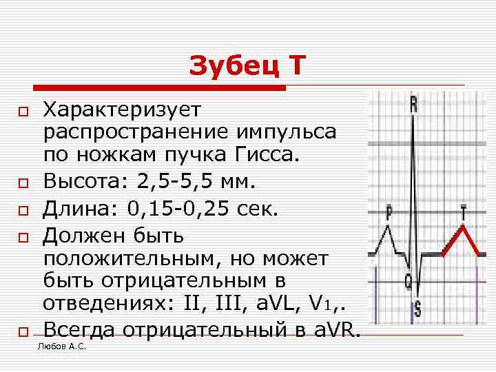   Зубец Т o  Характеризует распространение импульса по ножкам пучка Гисса.