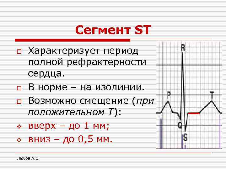    Сегмент ST o  Характеризует период полной рефрактерности сердца. o 