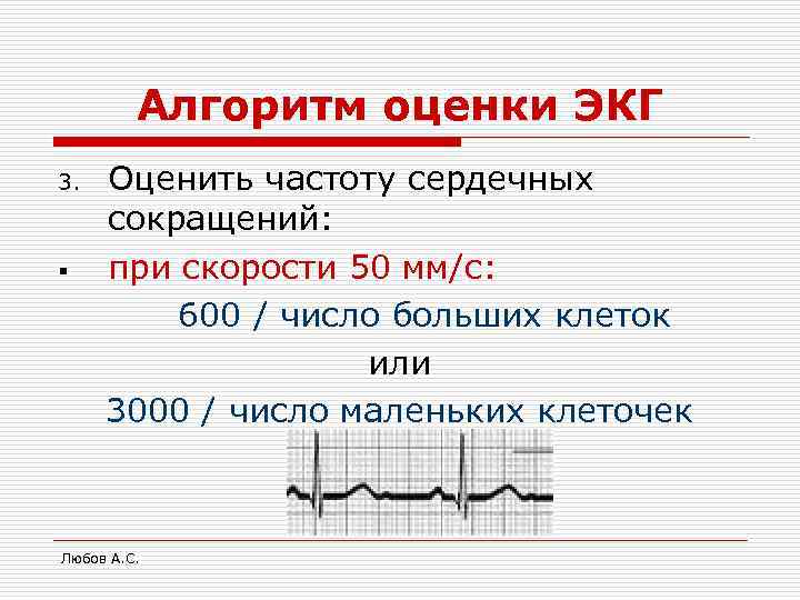    Алгоритм оценки ЭКГ 3.  Оценить частоту сердечных сокращений: § 