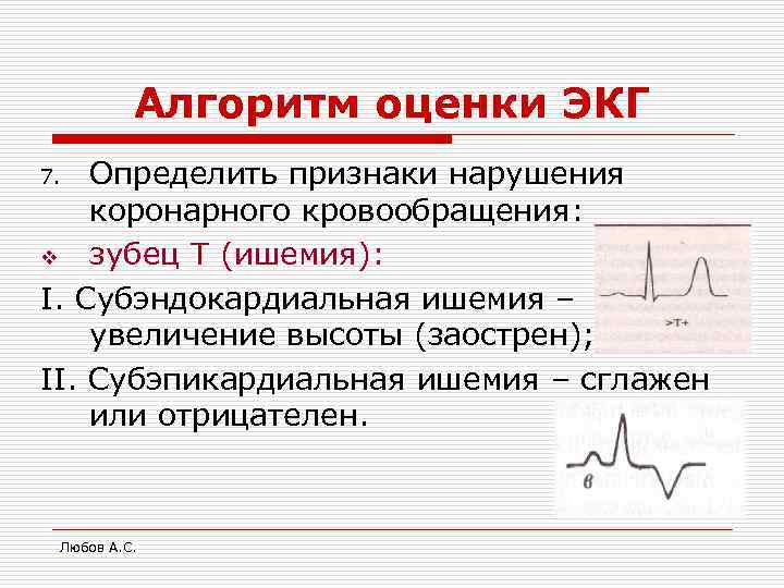    Алгоритм оценки ЭКГ 7.  Определить признаки нарушения коронарного кровообращения: v