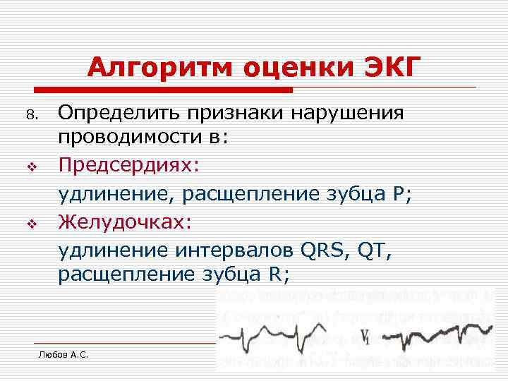    Алгоритм оценки ЭКГ 8. Определить признаки нарушения  проводимости в: v