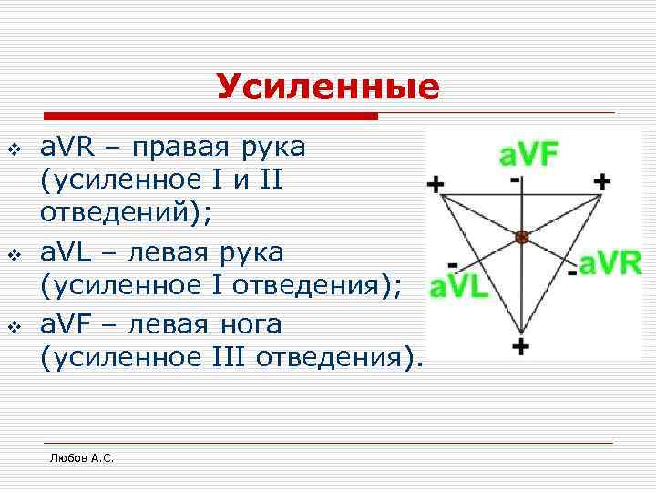    Усиленные v  a. VR – правая рука (усиленное I и