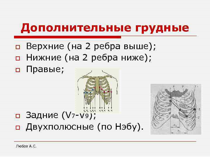   Дополнительные грудные o  Верхние (на 2 ребра выше); o  Нижние