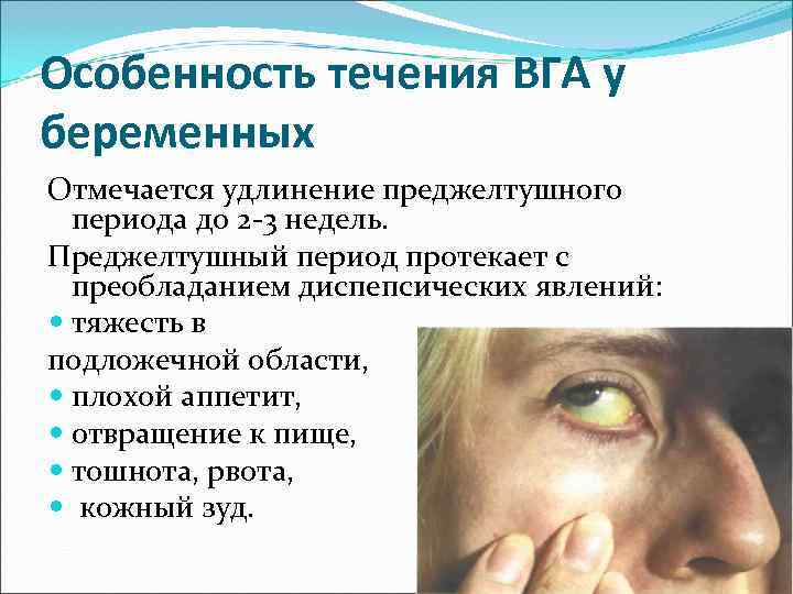 Особенность течения ВГА у беременных Отмечается удлинение преджелтушного  периода до 2 -3 недель.