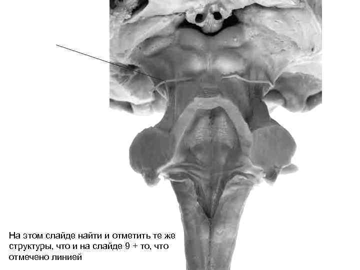 На этом слайде найти и отметить те же структуры, что и на слайде 9