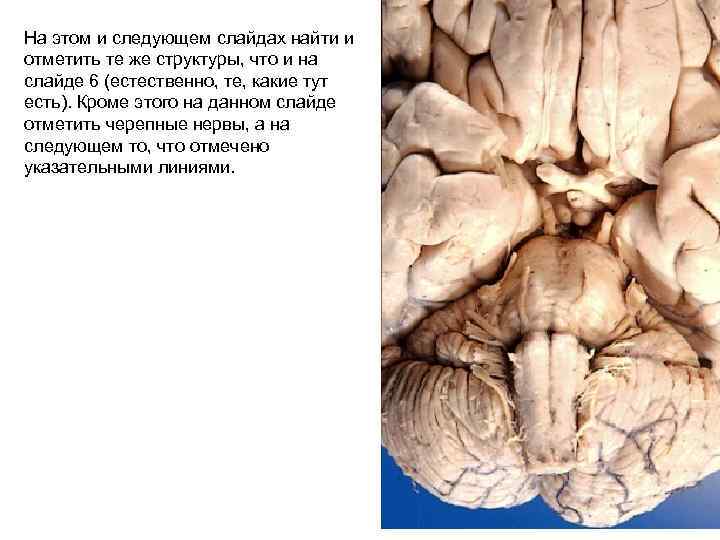 На этом и следующем слайдах найти и отметить те же структуры, что и на