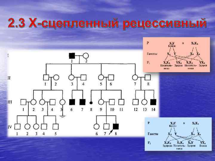 2. 3 X-сцепленный рецессивный 