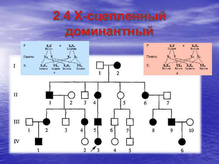 2. 4 X-сцепленный  доминантный 