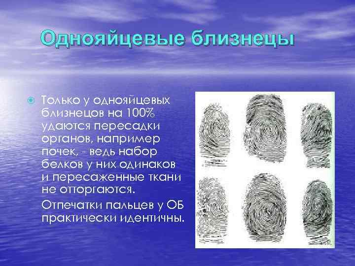   Однояйцевые близнецы Только у однояйцевых близнецов на 100% удаются пересадки органов, например