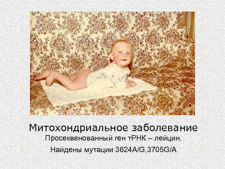 Митохондриальное заболевание  Просеквенованный ген т. РНК – лейцин. Найдены мутации 3624 A/G, 3705