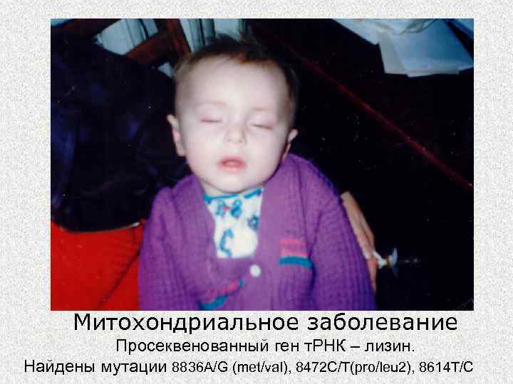  Митохондриальное заболевание   Просеквенованный ген т. РНК – лизин.  Найдены мутации