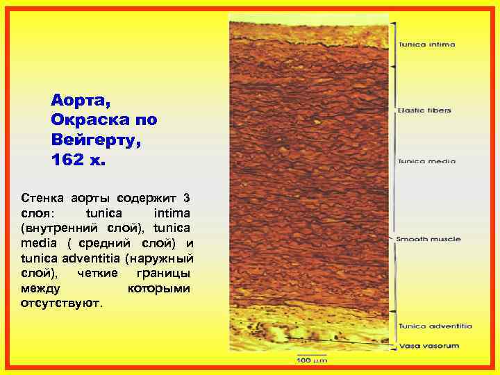  Аорта,  Окраска по Вейгерту,  162 x.  Стенка аорты содержит 3