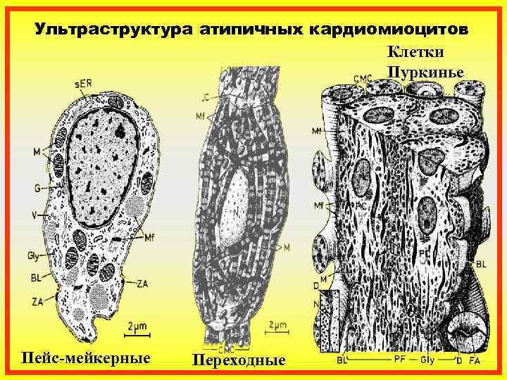 Атипичные мононуклеары картинки