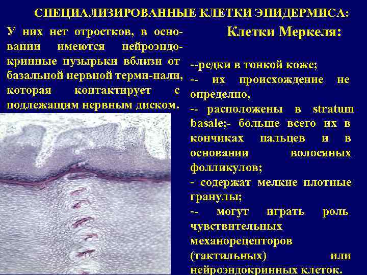   СПЕЦИАЛИЗИРОВАННЫЕ КЛЕТКИ ЭПИДЕРМИСА: У них нет отростков, в осно-   Клетки