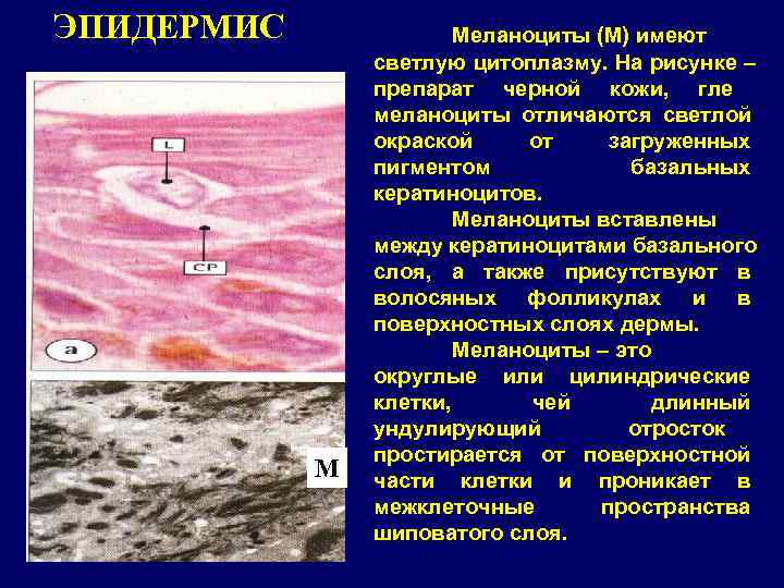 ЭПИДЕРМИС    Меланоциты (М) имеют   светлую цитоплазму. На рисунке –