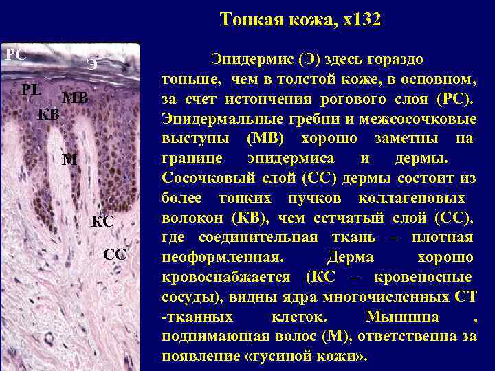      Тонкая кожа, x 132 РС    