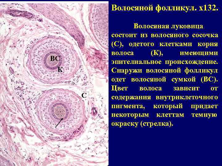    Волосяной фолликул. x 132.   Волосяная луковица   состоит