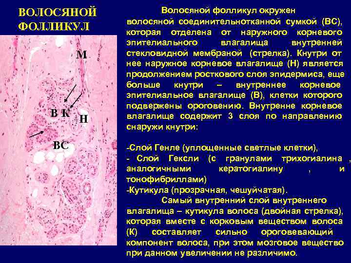 ВОЛОСЯНОЙ   Волосяной фолликул окружен   волосяной соединительнотканной сумкой (ВС), ФОЛЛИКУЛ 