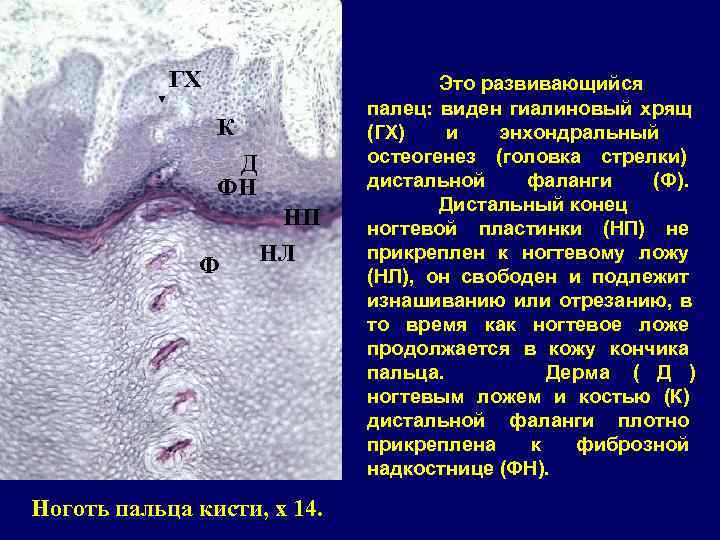   ГХ     Это развивающийся     палец: