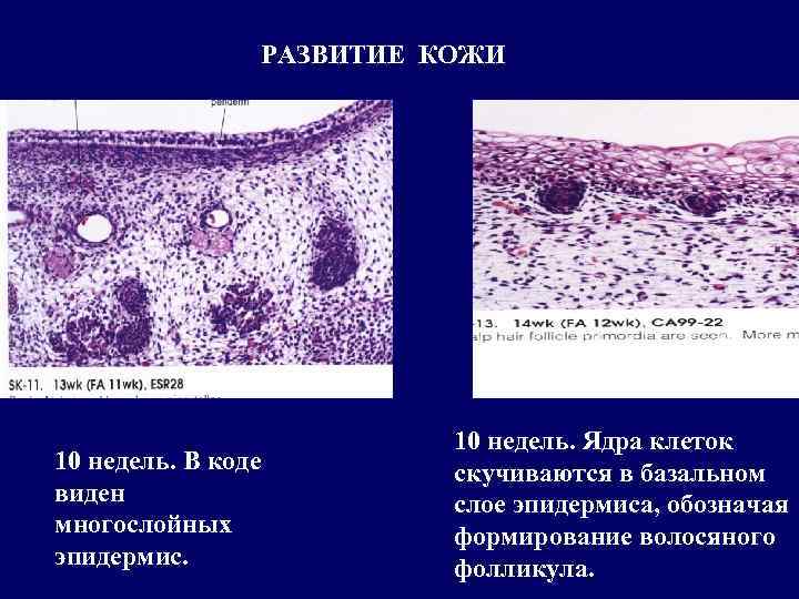     РАЗВИТИЕ КОЖИ      10 недель. Ядра