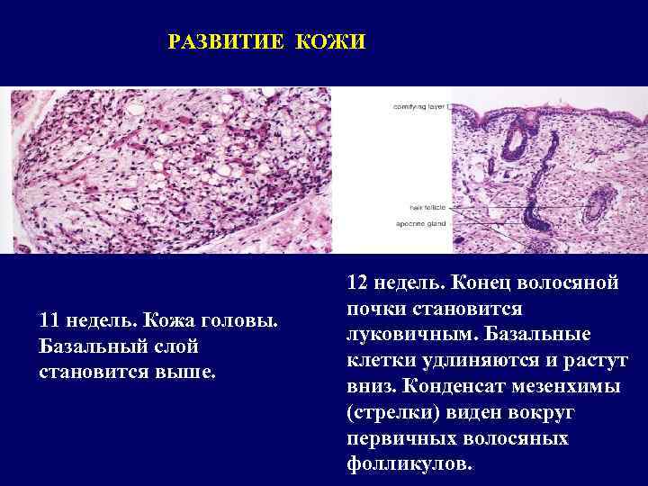 Развитие кожи. Источники развития кожи. Развитие кожи человека. Источники развития кожи гистология. Источники развития кожи и ее производных.