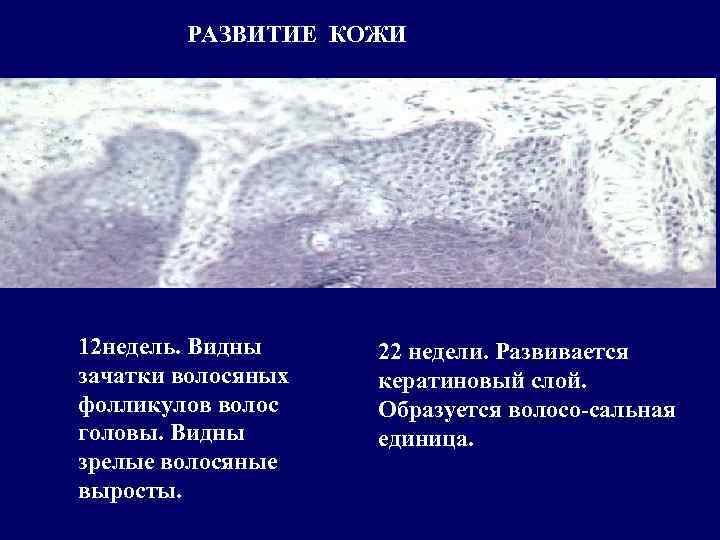 Развитие кожи