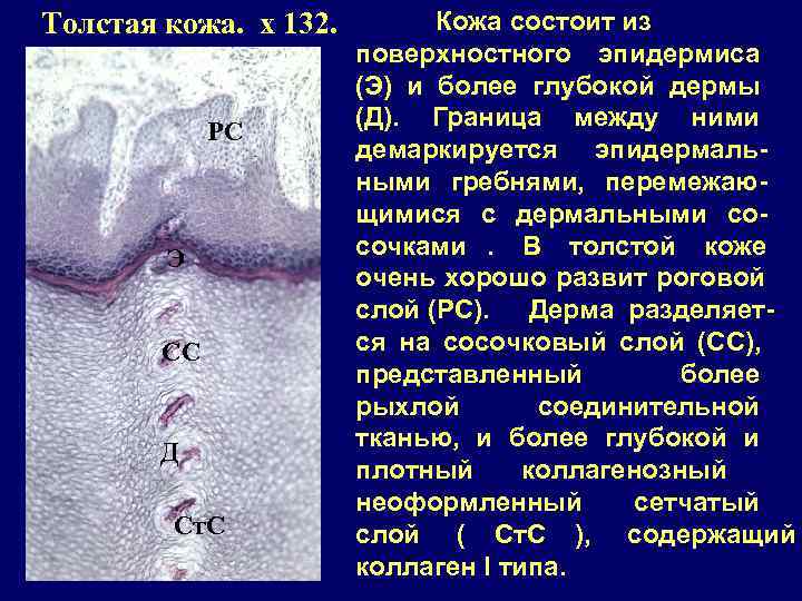 Толстая кожа. x 132.   Кожа состоит из    поверхностного эпидермиса