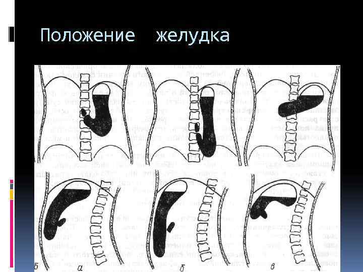 Положение желудка Положение желудка