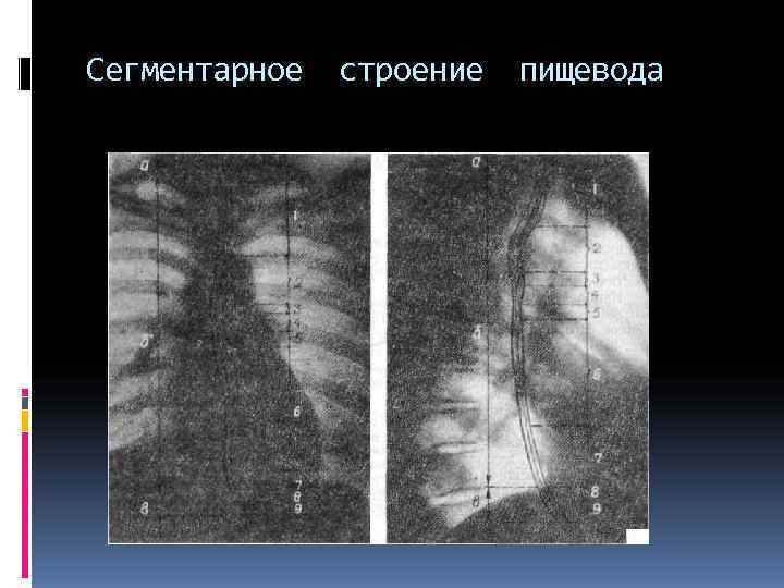 Сегментарное строение пищевода Сегментарное строение пищевода