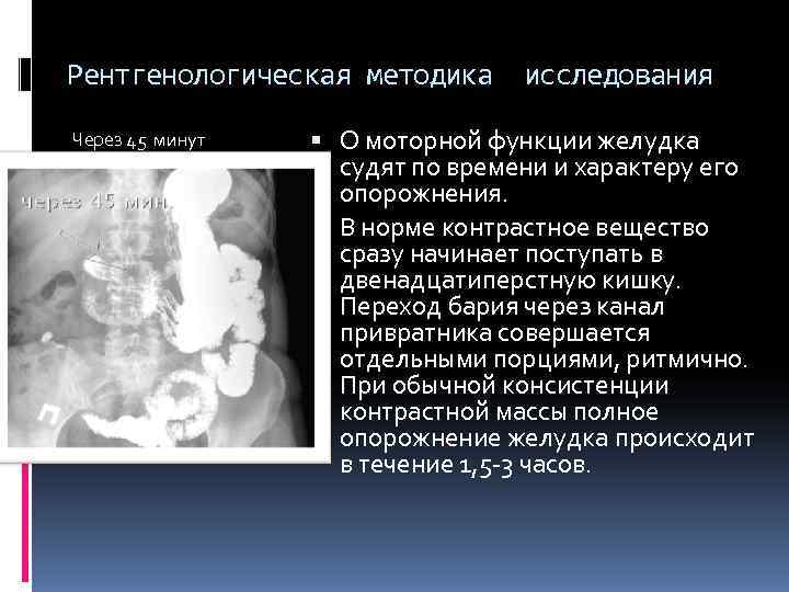 Рентгенологическая методика исследования Через 45 минут О моторной функции желудка судят Рентгенологическая методика исследования Через 45 минут О моторной функции желудка судят