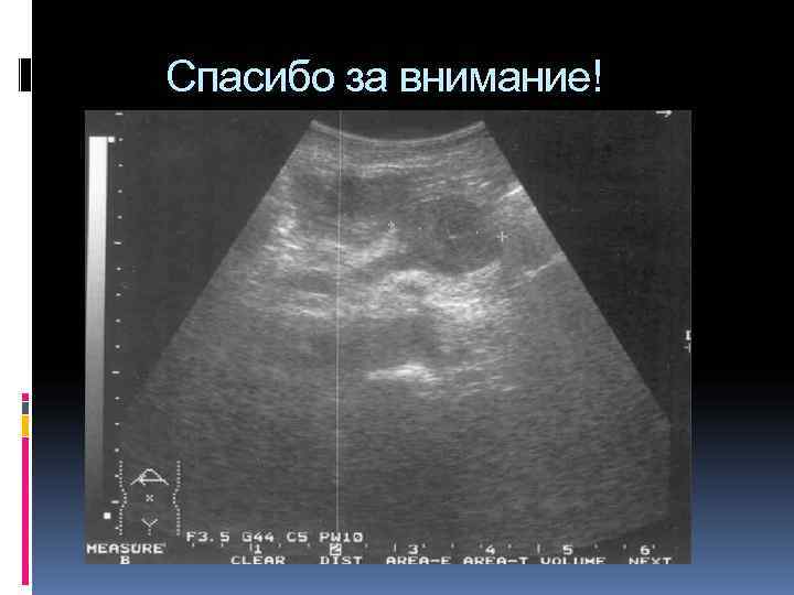 Спасибо за внимание! Спасибо за внимание!