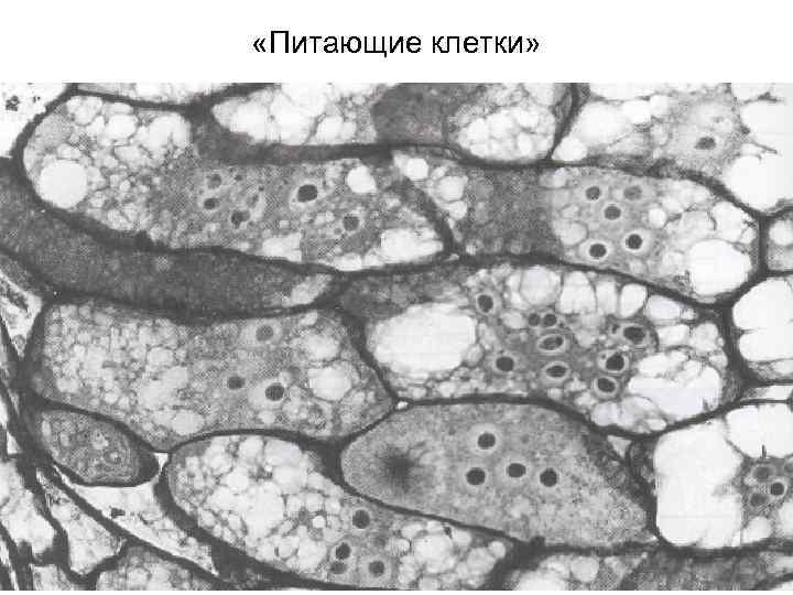  «Питающие клетки» 