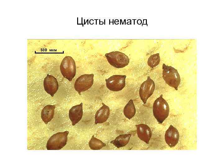 Цисты нематод 