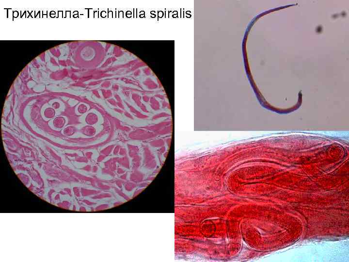 Трихинелла-Trichinella spiralis 