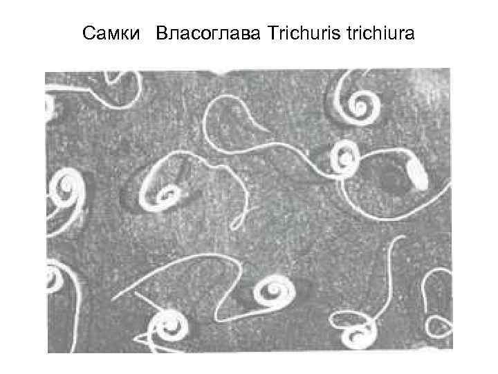 Самки Власоглава Trichuris trichiura 