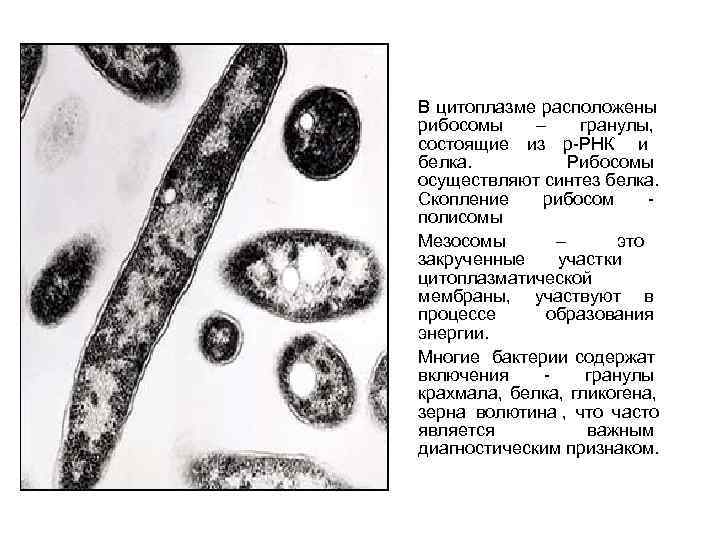 В цитоплазме расположены  рибосомы – гранулы,  состоящие из р-РНК и  белка.