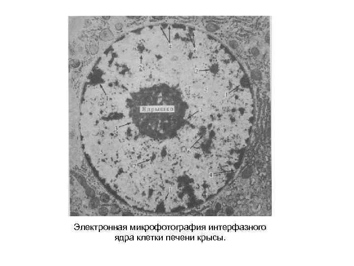 Электронная микрофотография интерфазного ядра клетки печени крысы. 