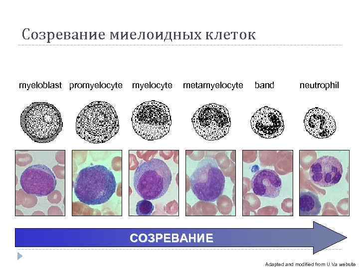 Созревание миелоидных клеток  myeloblast promyelocyte  metamyelocyte  band  neutrophil  