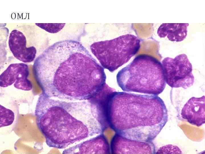 ОМЛ 