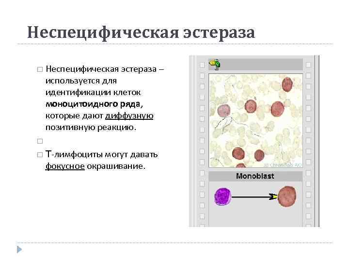 Неспецифическая эстераза – используется для идентификации клеток моноцитоидного ряда,  которые дают диффузную позитивную