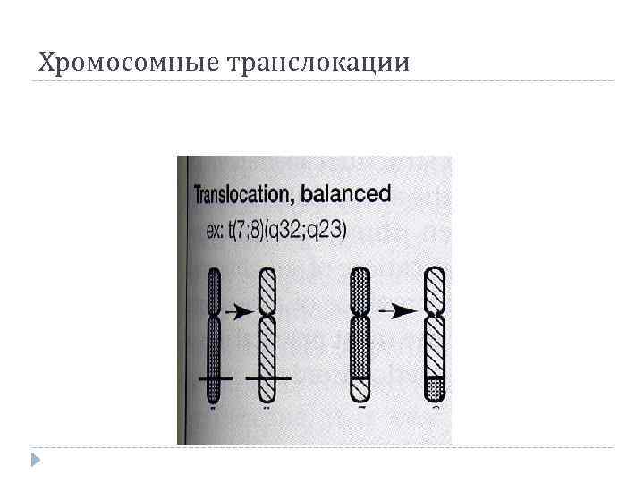 Хромосомные транслокации 