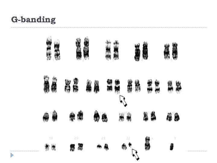 G-banding    1  2   3   4 