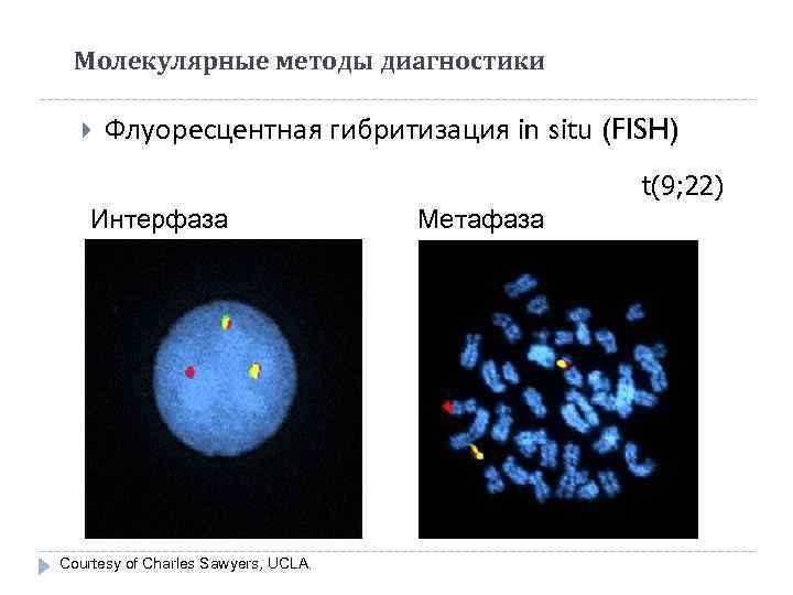  Молекулярные методы диагностики  Флуоресцентная гибритизация in situ (FISH)    