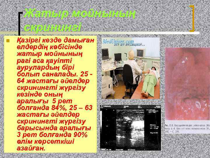  Жатыр мойнының скринингі n  Қазіргі кезде дамыған елдердің көбісінде жатыр мойнының рагі
