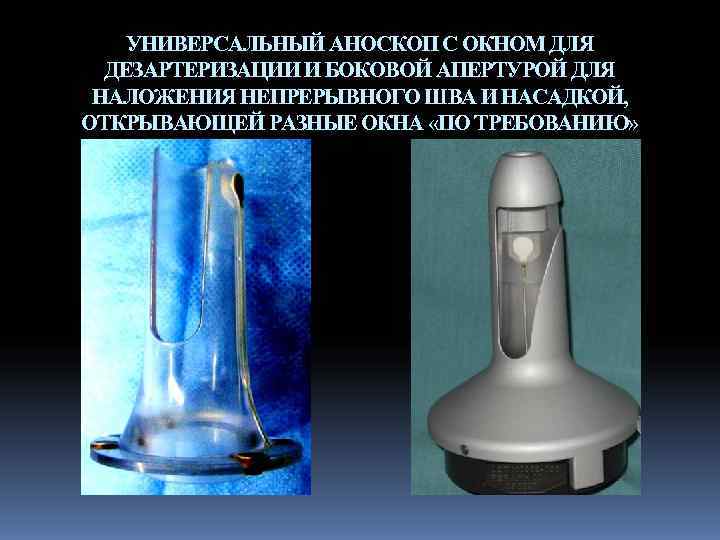   УНИВЕРСАЛЬНЫЙ АНОСКОП С ОКНОМ ДЛЯ  ДЕЗАРТЕРИЗАЦИИ И БОКОВОЙ АПЕРТУРОЙ ДЛЯ НАЛОЖЕНИЯ