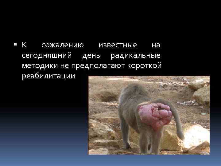  К  сожалению  известные  на  сегодняшний день радикальные  методики