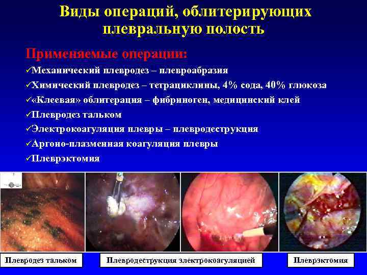   Виды операций, облитерирующих   плевральную полость Применяемые операции: ü Механический плевродез