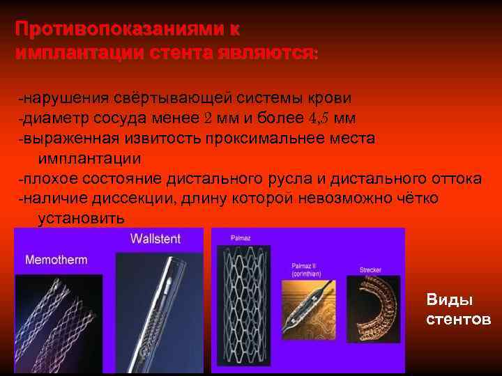 Противопоказаниями к имплантации стента являются:  -нарушения свёртывающей системы крови -диаметр сосуда менее 2